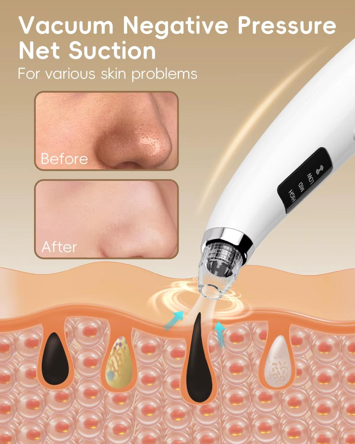 Blackhead Remover Pore Vacuum Facial Pore Cleaner Electric Whitehead Extractor Tool-5 Suction Power Skin Scrubber Beauty Care